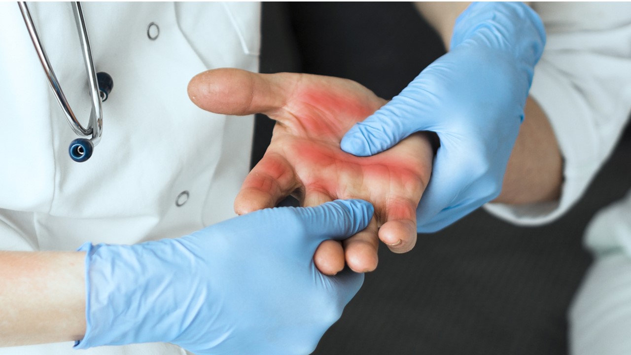 Manejo Básico del Paciente Gran Quemado 2025